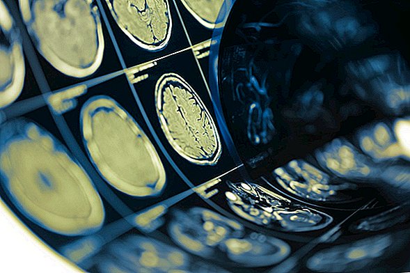 Otak Perempuan Berumur 3 Tahun Daripada Lelaki, Kajian mencadangkan