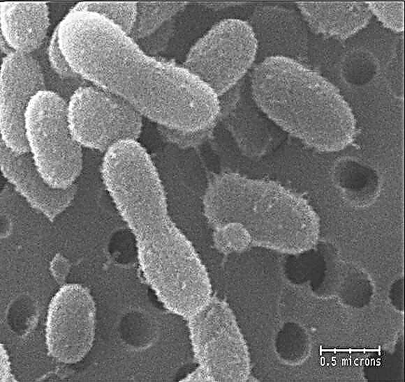Winziges, tiefgefrorenes grönländisches Bakterium kann außerirdische Hinweise enthalten