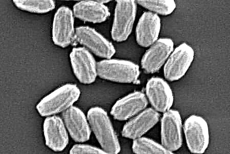 I batteri potrebbero sopravvivere nel suolo marziano